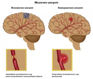 Здраве